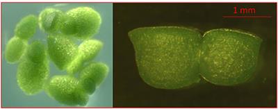 Development of Wolffia arrhiza as a Producer for Recombinant Human Granulocyte Colony-Stimulating Factor